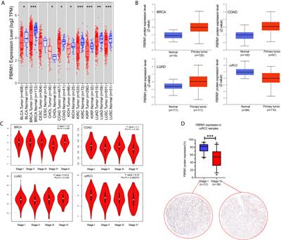 Mutational Analysis of PBRM1 and Significance of PBRM1 Mutation in Anti-PD-1 Immunotherapy of Clear Cell Renal Cell Carcinoma